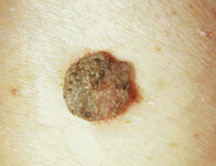 Dermatology - Wikipedia