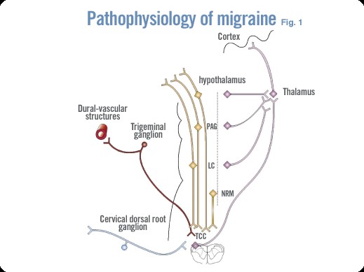 Figure 1. The pathophysiology of migraine. TCC = trigeminal cervical complex; NRM = nucleus raphe magnus; LC = locus coerulus; PAG = periaqueductal grey