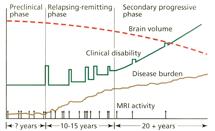 Ms Treatment Comparison Chart