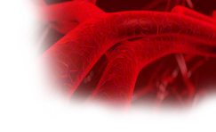 Thrombophlebitis in a 55 Year Old Woman