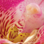 Female Sexual Dysfunction