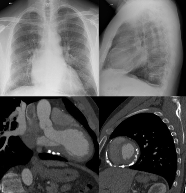 3 Ways Upright Cardiac Imaging Is Different From Supine