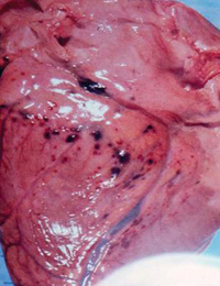 Hemorrhagic pericarditis