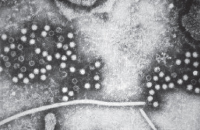 Hepatitis E particles in stool