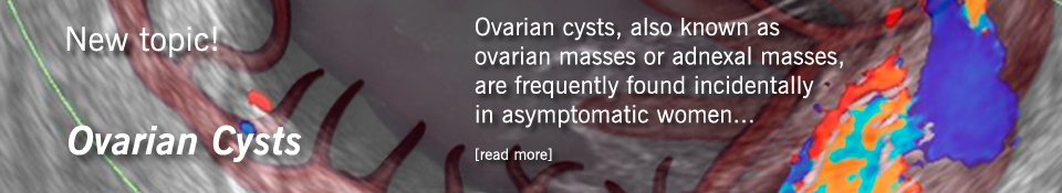 Ovarian Cysts