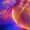 Tall Rounds®          Treatment Options & Interventions for Anomalies of the Coronary Arteries